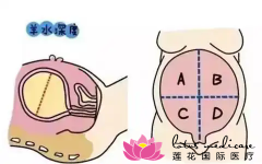 什么是羊水过多？羊水过多的原因和后续检查要了解！